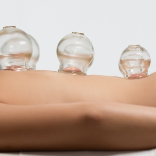 Cupping-Myofascial-Decompression-The-FItness-Lab-Highlands-Ranch-Parker-Denver-Greenwood-Village-CO